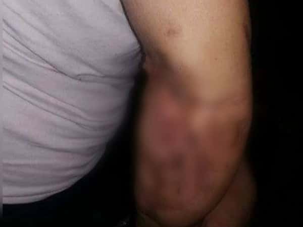 Surgery for a Syrian Patient