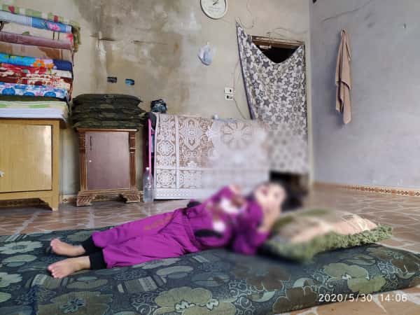 طفلة تعاني من ضمور دماغي وبحاجة للمساعدة
