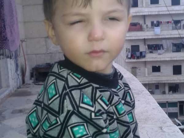 A baby suffers from Phengophobia!