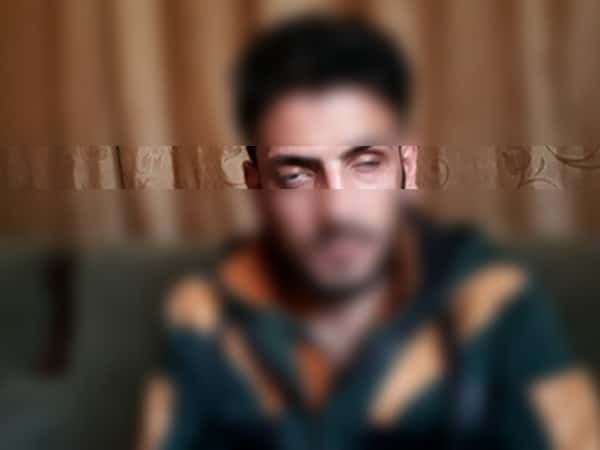 شاب فقد عينه