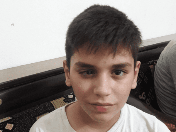 Child might loss his eyesight