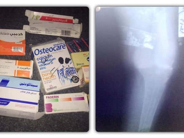 A lady in need of surgery