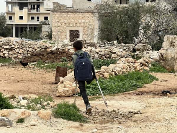 بساقٍ واحدة … وحياةٌ كاملة من الألم