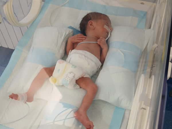 The little girl, Salam, is in a critical condition.