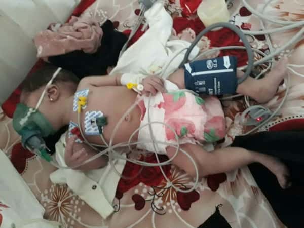 الرضيعة منال تعاني من مشاكل قلبية وتحتاج مساعدة