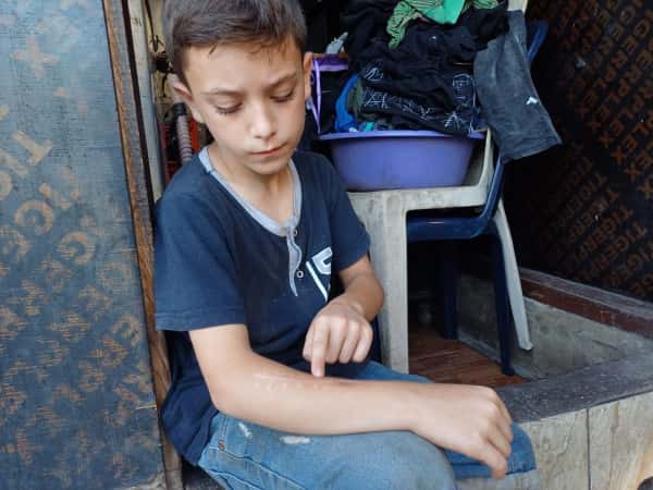 A broken arm is preventing Yusuf from living his life like any other child.