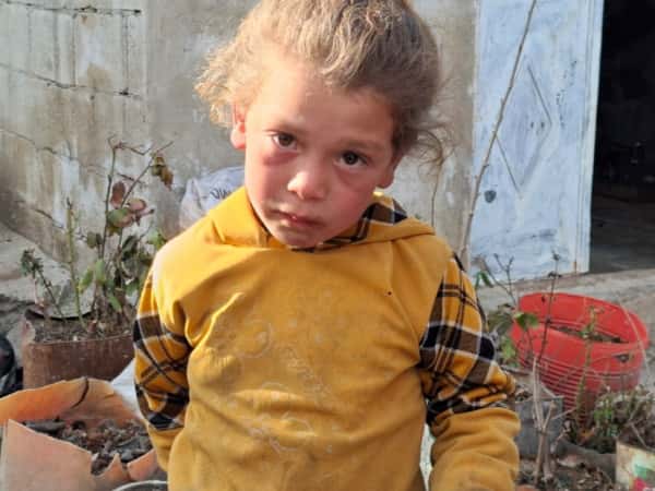 طفولة تُصارع المرض في خيمة النزوح