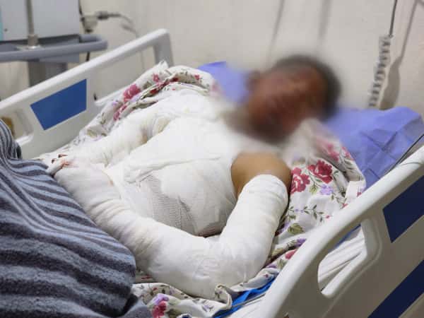 لم تدفئه نار المدفاة بل احرقت جسده