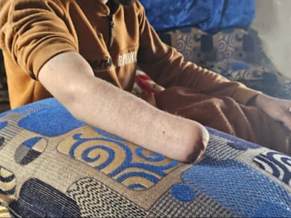 مأواهم الوحيد أصبح رماداً