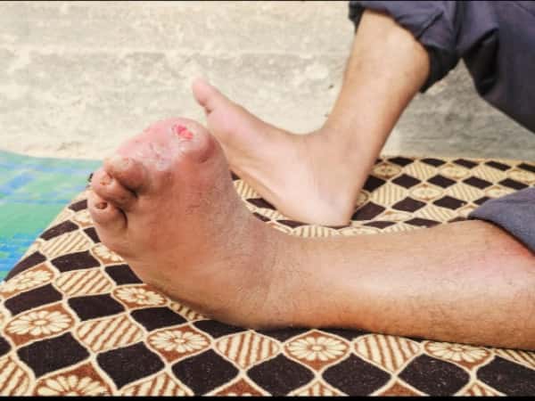 A New Hope for a Man Worn Down by Illness