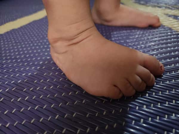 Hasan is a child who needs help!