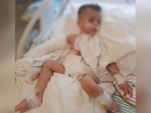 A boy was injured by shelling