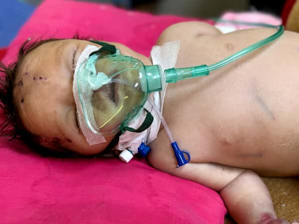 Give Little Nour a Chance to Live