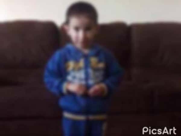 A Child Suffers from Fryns syndrome
