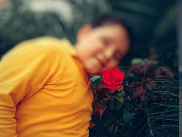 A child had deformities because of shelling