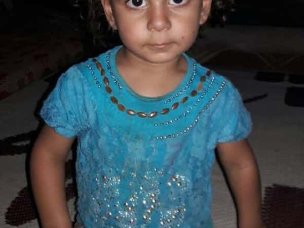 Child suffering from hemorrhagic disease