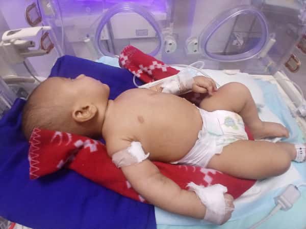 A newborn baby suffers from several diseases.