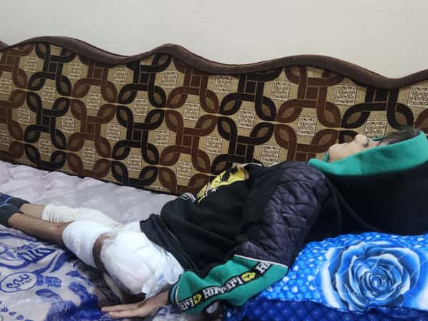 Ahmed needs your help to reduce his pain.
