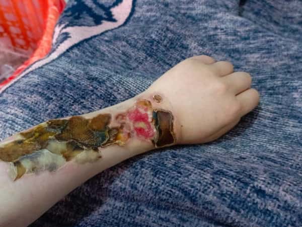 She is in severe pain and needs your help!
