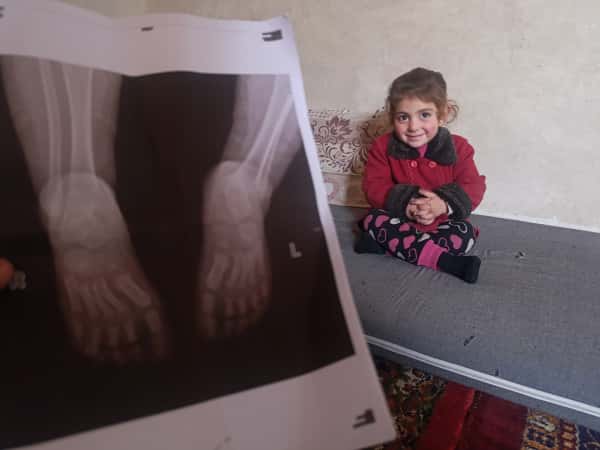 A childhood that suffers with every step