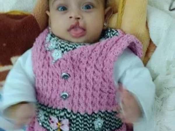A newly born baby in need for a surgery