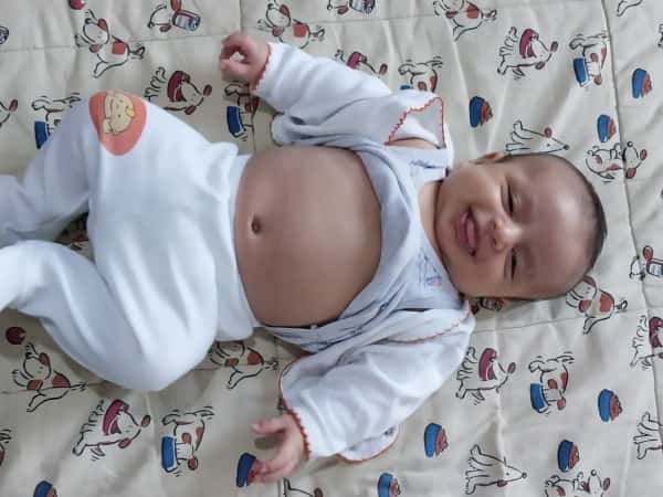 A child suffering from kidney swelling and in need of an urgent surgery