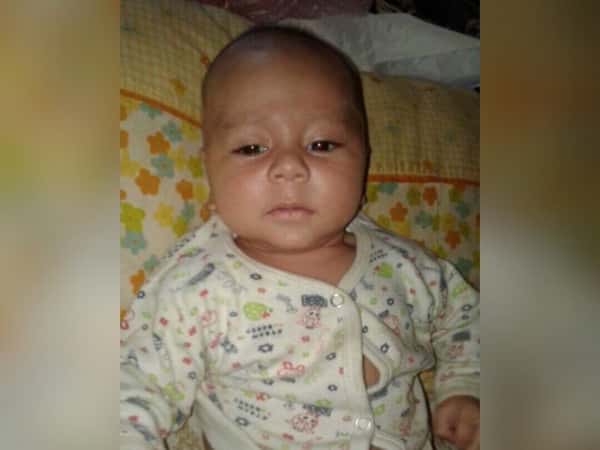 Child suffering from neural convulsions