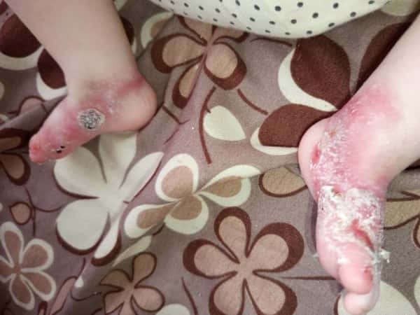 A Child in Pain: Help Bushra Care for Her Son