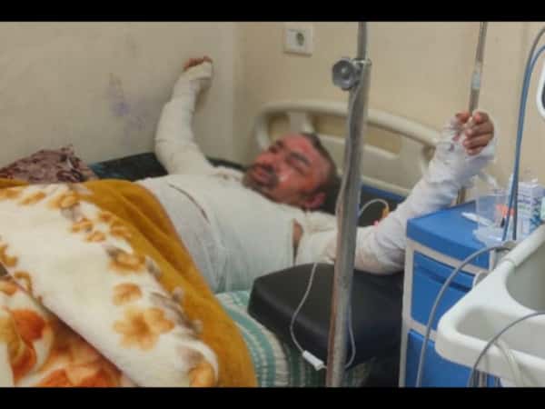 محمد… حروق شديدة غيّرت مجرى حياته