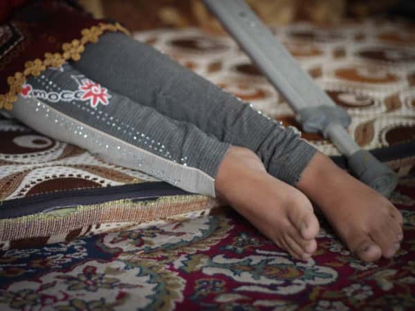 A girl child needs a surgery