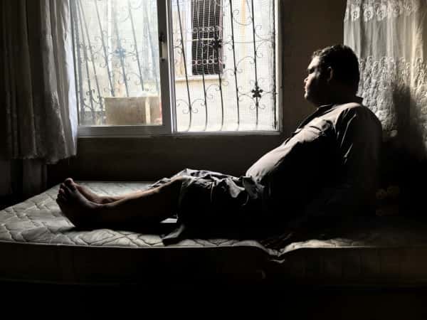 A man needs varicose veins surgery