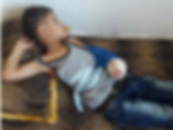Child suffering from a broken elbow ligament