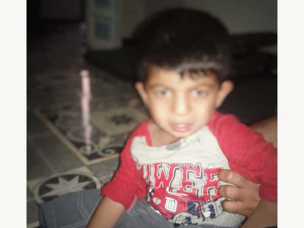 Ahmad was born with cerebral atrophy