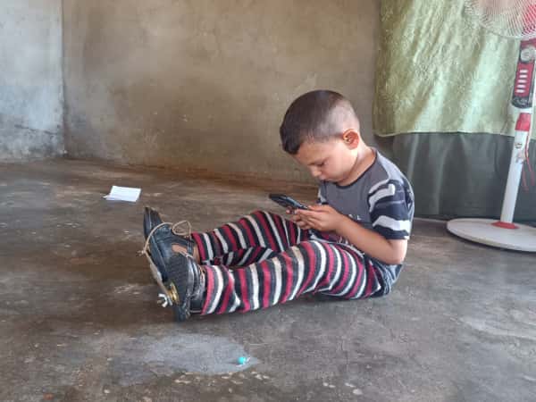 Ahmed is a child suffering from clubfoot and urgently needs treatment.