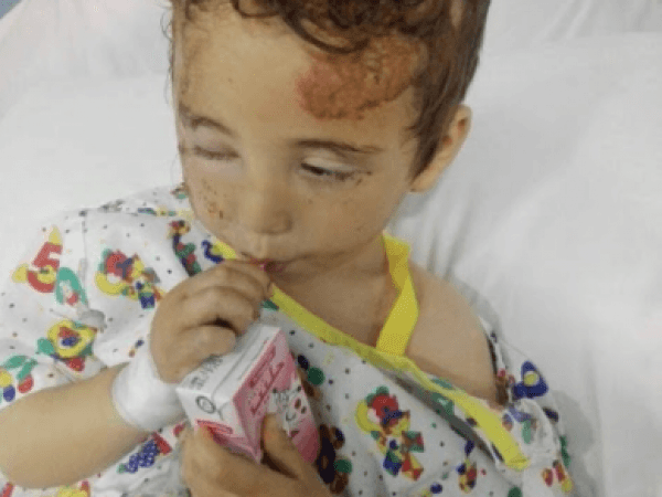 A child in need for CT scans and recovery costs.