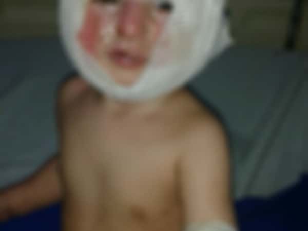 A family needs treatment costs and living expenses