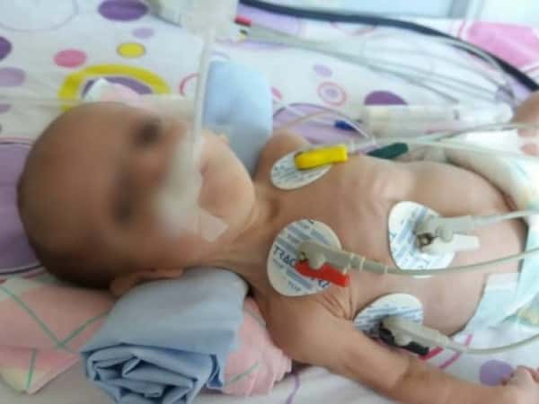 a kid with a heart disease