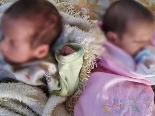 treatment expenses for little twins