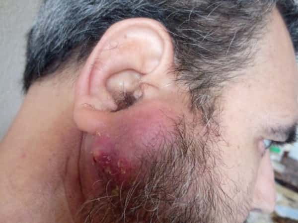 Ahmed has throat cancer and needs your help!