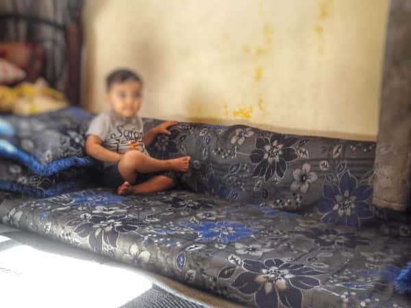 A child suffers from out-toeing