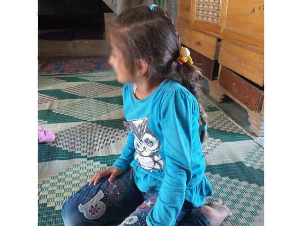 طفلة تعاني من انكماش أوتار إصبعيها!