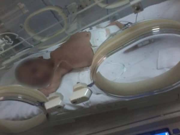 Treatment expenses for a child