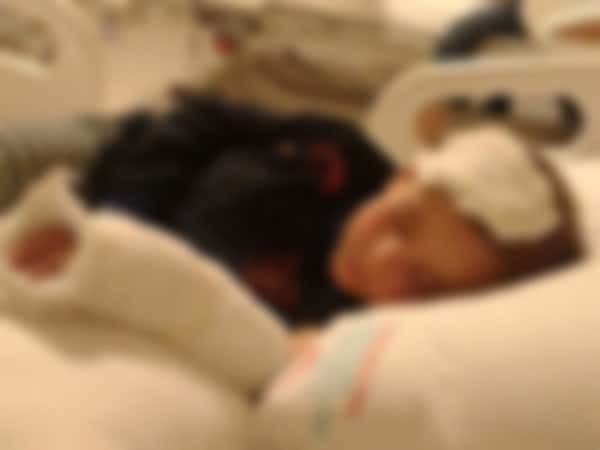 A Child Suffers from Lymphoma Cancer