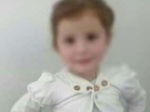 Infant needs open heart surgery