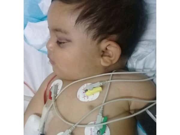 طفل تعرض للضرب من قبل زوج أمه!