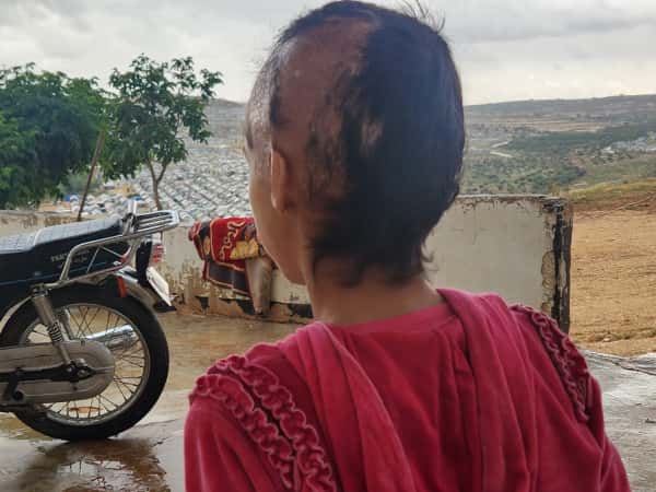 Hala is in need of help after being injured in a fire