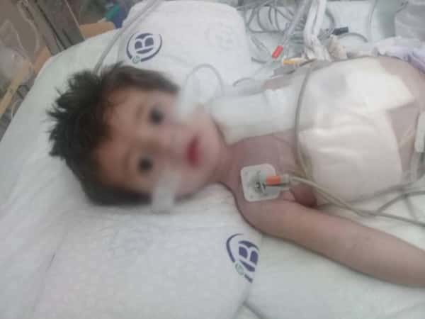 A newborn girl needs treatment expenses