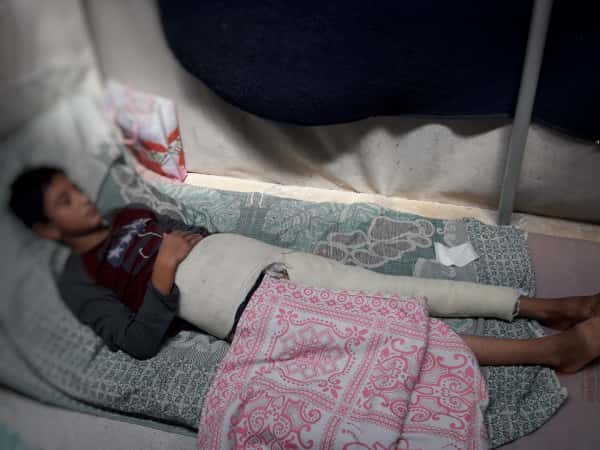 A child suffered a broken foot and lives in tragic circumstances!
