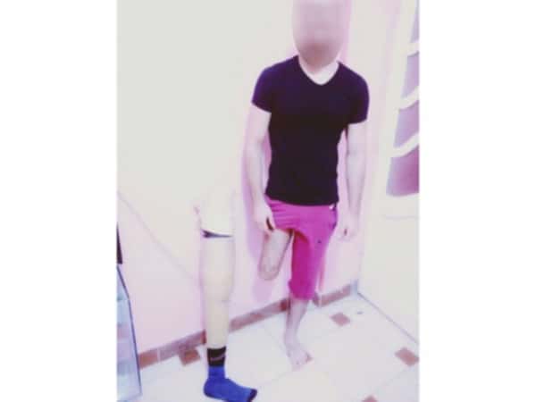 A Young Man with a Leg Amputation and a Renal Fatigue Needs Help