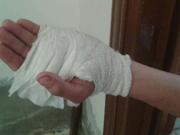 A kid needs an urgent operation for his hand